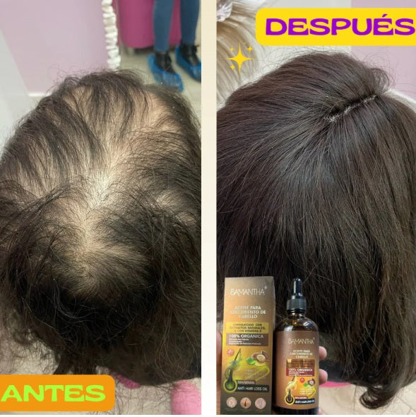 SERUM PARA CRECMIENTO CAPILAR