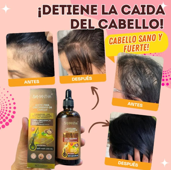 SERUM PARA CRECMIENTO CAPILAR